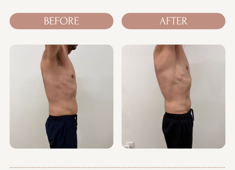 Joe_IQ_Before_After