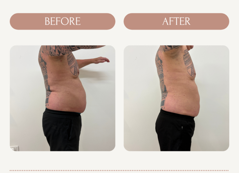 John_IQ_Before_After