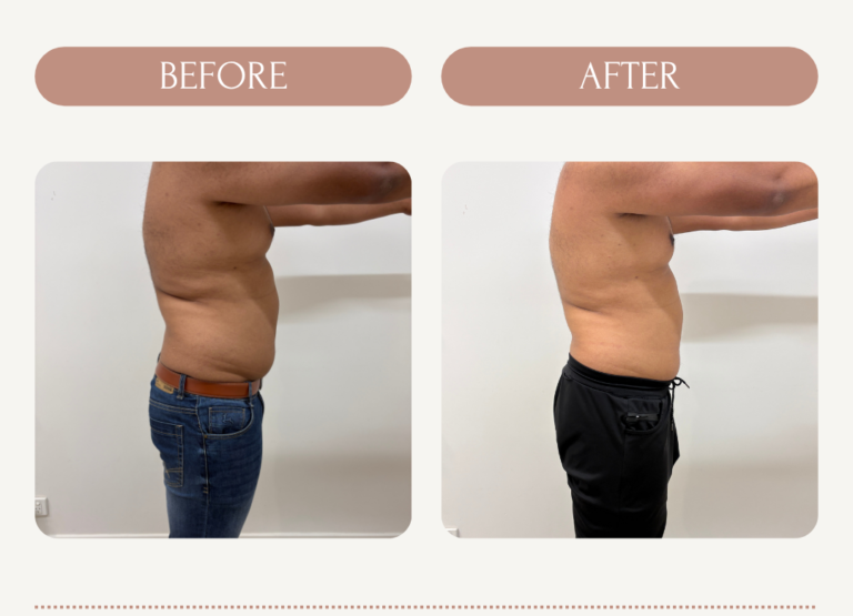 Tejas_IQ_Before_After