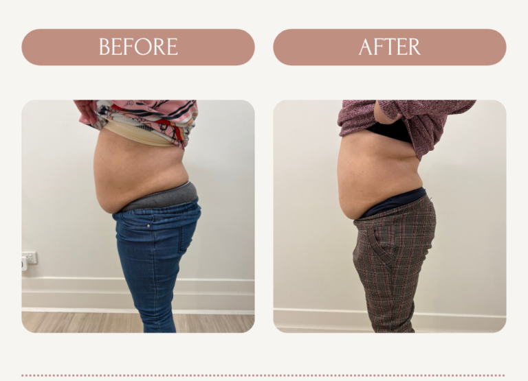 Tessa_IQ_Before_After