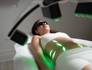 Client receiving green laser lipo on the stomach at BM Aesthetics Richmond